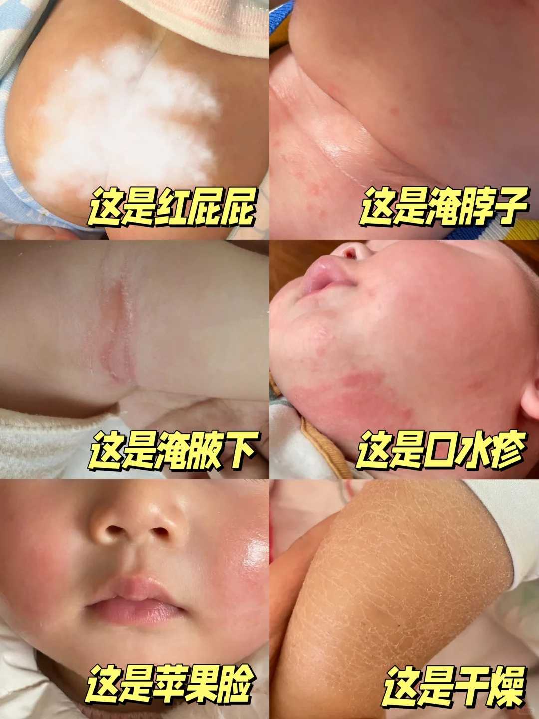 （国内代生咨询）为什么三代试管筛查后胚胎还会发育畸形
						